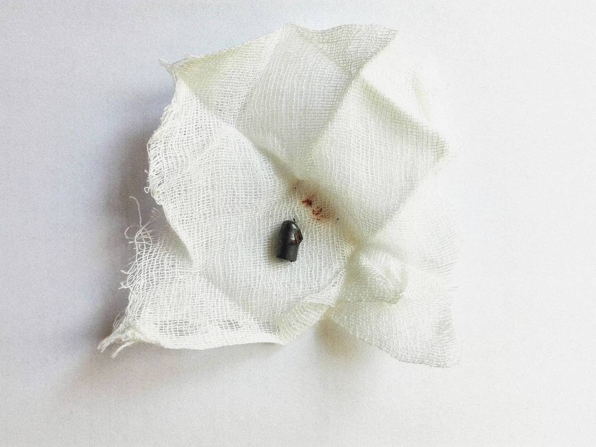 Jádro střely vyňaté z rány na hlavě Julia Farkaše. Postřelen byl u Stavovského divadla večer 21. srpna 1969.