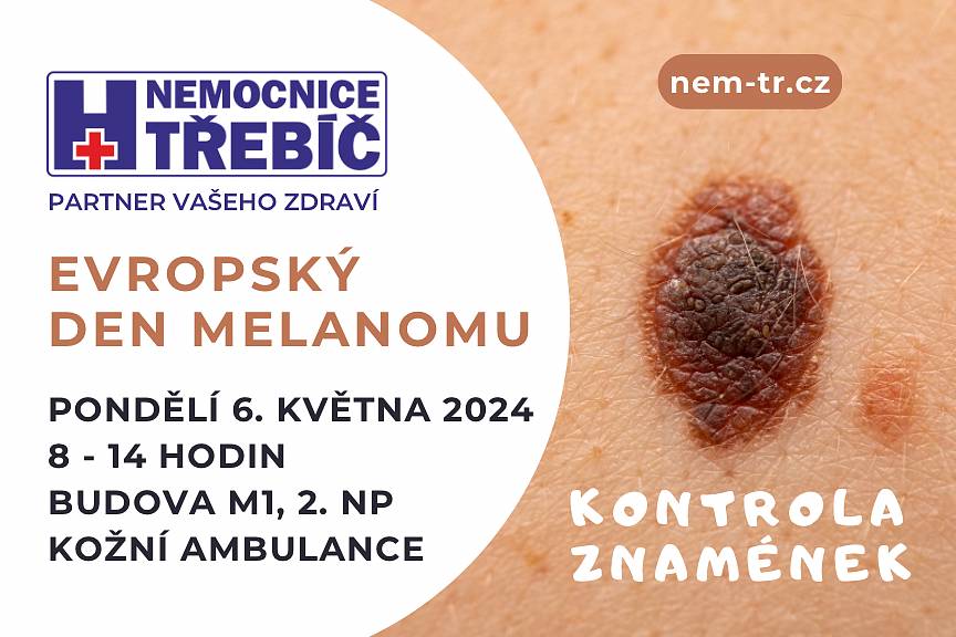 Kdy: v pondělí 6. května 2024