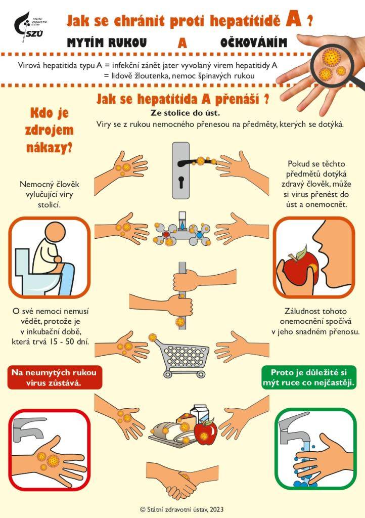 V Ústeckém kraji, včetně okresu Teplice, se zvýšil výskyt hepatitidy A.