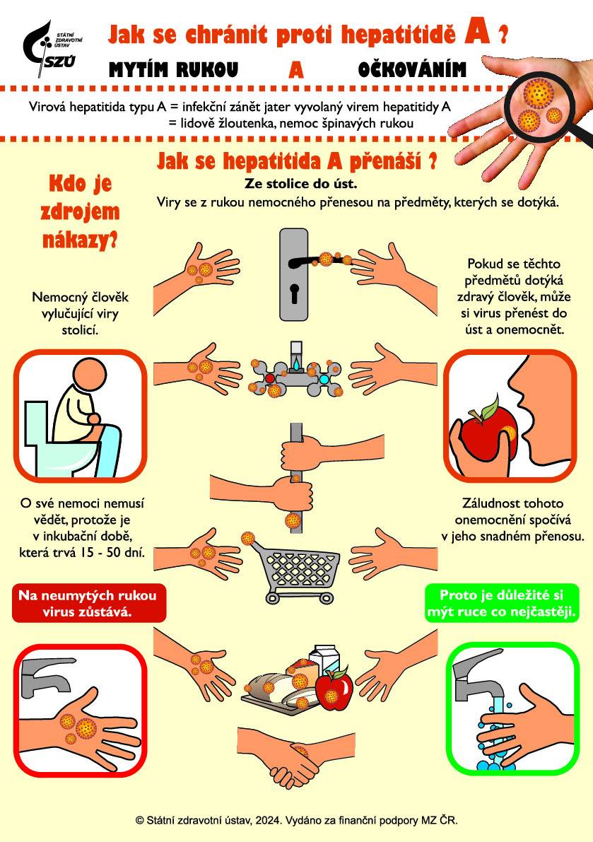 V průběhu roku 2025 je dlouhodobě zaznamenáván zvýšený výskyt virové hepatitidy A, který se promítá také do situace v Olomouckém kraji. Toto vysoce nakažlivé onemocnění se v současné době vyskytuje napříč všemi věkovými skupinami obyvatel. K přenosu dochází zejména v prostředí s vyšší koncentrací osob, což zvyšuje riziko možného šíření infekce právě v období hromadných kulturních a společenských akcí spojených s občerstvením.  Z tohoto důvodu připomínáme základní informace o onemocnění a doporučení, která mohou pomoci minimalizovat riziko přenosu nákazy.