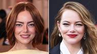 Možná se tak narodila, možná to jsou „neviditelné“ plastiky. Herečka Emma Stone šokuje vizáží